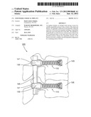 EXPANDABLE SURGICAL IMPLANT diagram and image