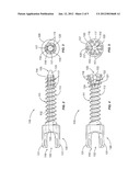 EXPANDABLE SURGICAL IMPLANT diagram and image