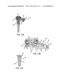 PEDICULAR FACET FUSION SCREW WITH PLATE diagram and image