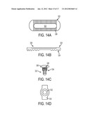 PEDICULAR FACET FUSION SCREW WITH PLATE diagram and image