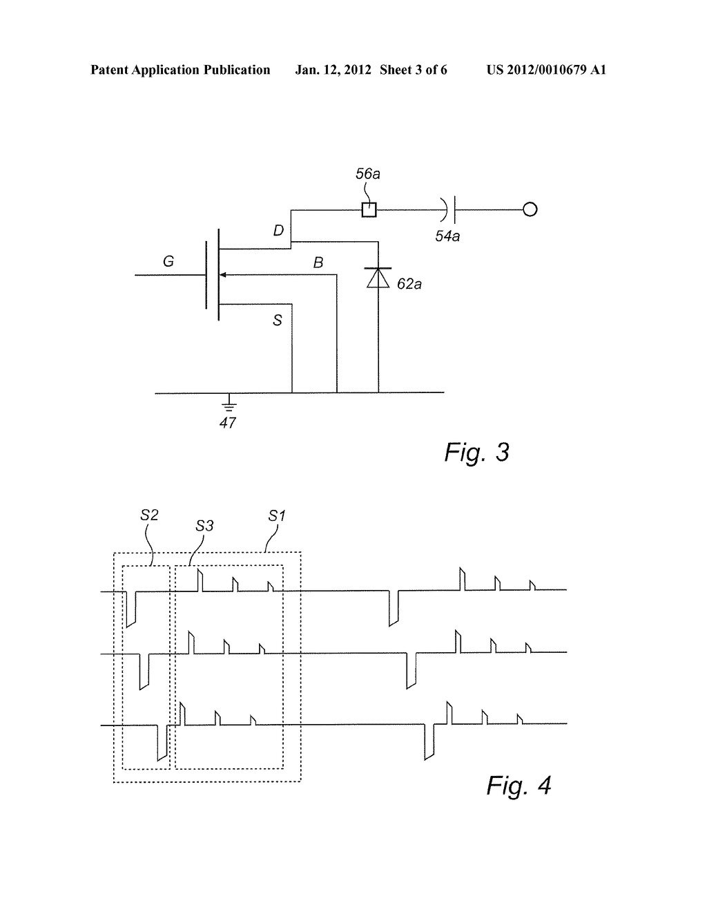 IMPLANTED HEART-STIMULATION DEVICE ENABLING CHARGE BALANCE AFTER     STIMULATION SEQUENCE - diagram, schematic, and image 04