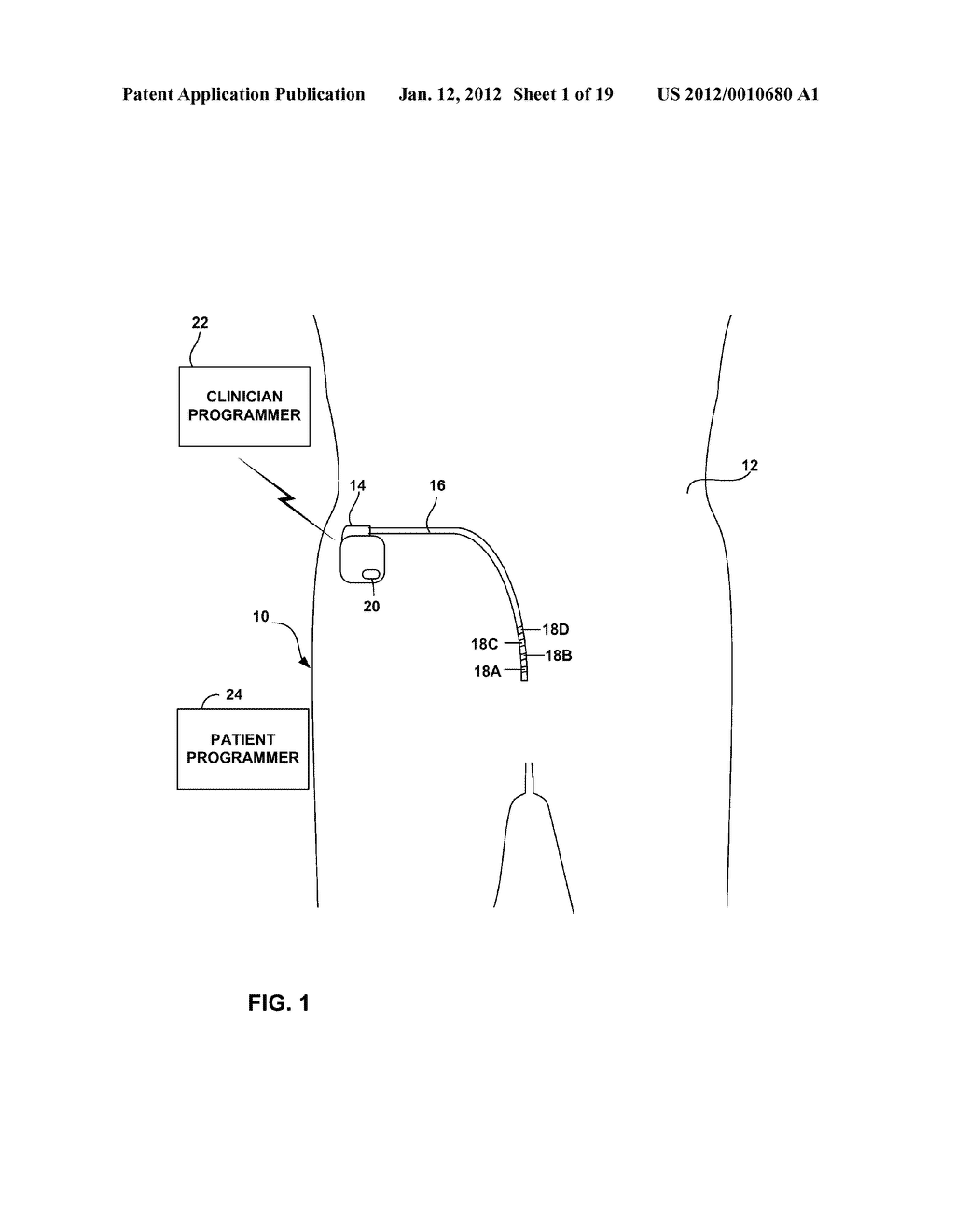 CONDITIONAL ELECTRICAL STIMULATION - diagram, schematic, and image 02