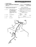 Obstructive Sleep Apnea Treatment Devices, Systems and Methods diagram and image