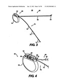 Obstructive Sleep Apnea Treatment Devices, Systems and Methods diagram and image