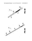 Obstructive Sleep Apnea Treatment Devices, Systems and Methods diagram and image