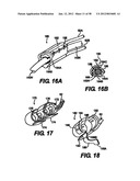 Obstructive Sleep Apnea Treatment Devices, Systems and Methods diagram and image