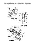 Obstructive Sleep Apnea Treatment Devices, Systems and Methods diagram and image