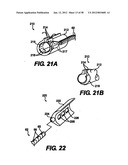 Obstructive Sleep Apnea Treatment Devices, Systems and Methods diagram and image