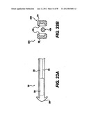 Obstructive Sleep Apnea Treatment Devices, Systems and Methods diagram and image