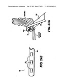 Obstructive Sleep Apnea Treatment Devices, Systems and Methods diagram and image