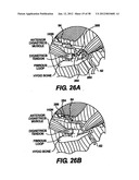 Obstructive Sleep Apnea Treatment Devices, Systems and Methods diagram and image