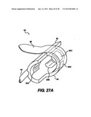 Obstructive Sleep Apnea Treatment Devices, Systems and Methods diagram and image