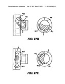 Obstructive Sleep Apnea Treatment Devices, Systems and Methods diagram and image