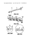 Obstructive Sleep Apnea Treatment Devices, Systems and Methods diagram and image