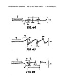 Obstructive Sleep Apnea Treatment Devices, Systems and Methods diagram and image