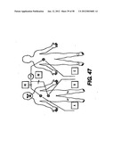 Obstructive Sleep Apnea Treatment Devices, Systems and Methods diagram and image