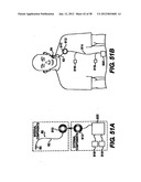 Obstructive Sleep Apnea Treatment Devices, Systems and Methods diagram and image