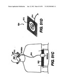 Obstructive Sleep Apnea Treatment Devices, Systems and Methods diagram and image