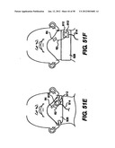 Obstructive Sleep Apnea Treatment Devices, Systems and Methods diagram and image