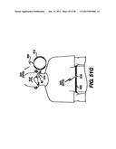 Obstructive Sleep Apnea Treatment Devices, Systems and Methods diagram and image