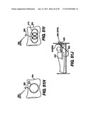 Obstructive Sleep Apnea Treatment Devices, Systems and Methods diagram and image