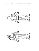 Obstructive Sleep Apnea Treatment Devices, Systems and Methods diagram and image