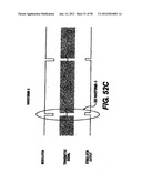 Obstructive Sleep Apnea Treatment Devices, Systems and Methods diagram and image