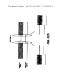 Obstructive Sleep Apnea Treatment Devices, Systems and Methods diagram and image