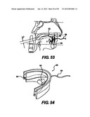 Obstructive Sleep Apnea Treatment Devices, Systems and Methods diagram and image