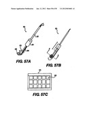 Obstructive Sleep Apnea Treatment Devices, Systems and Methods diagram and image