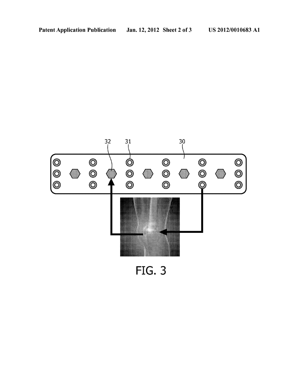  METHOD AND APPARATUS FOR CONTROLLING A PROCESS OF INJURY THERAPY - diagram, schematic, and image 03