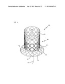 HEART VALVE PROSTHESIS USING DIFFERENT TYPES OF LIVING TISSUE AND METHOD     OF FABRICATING THE SAME diagram and image