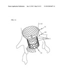 HEART VALVE PROSTHESIS USING DIFFERENT TYPES OF LIVING TISSUE AND METHOD     OF FABRICATING THE SAME diagram and image