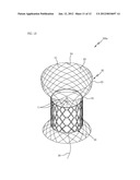 HEART VALVE PROSTHESIS USING DIFFERENT TYPES OF LIVING TISSUE AND METHOD     OF FABRICATING THE SAME diagram and image