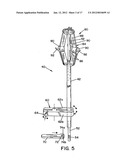 METHOD AND APPARATUS FOR PROSTHETIC VALVE REMOVAL diagram and image