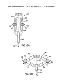 METHOD AND APPARATUS FOR PROSTHETIC VALVE REMOVAL diagram and image