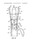 METHOD AND APPARATUS FOR PROSTHETIC VALVE REMOVAL diagram and image