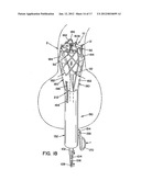 METHOD AND APPARATUS FOR PROSTHETIC VALVE REMOVAL diagram and image