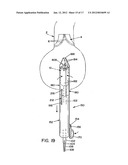 METHOD AND APPARATUS FOR PROSTHETIC VALVE REMOVAL diagram and image