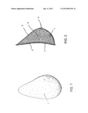 Light-Weight External Breast Prosthesis diagram and image