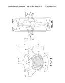 SPINAL IMPLANT FOR USE DURING RETROPERITONEAL LATERAL INSERTION PROCEDURES diagram and image