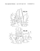 SPINAL IMPLANT FOR USE DURING RETROPERITONEAL LATERAL INSERTION PROCEDURES diagram and image