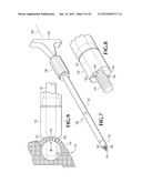 SPINAL IMPLANT FOR USE DURING RETROPERITONEAL LATERAL INSERTION PROCEDURES diagram and image