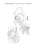 SPINAL IMPLANT FOR USE DURING RETROPERITONEAL LATERAL INSERTION PROCEDURES diagram and image