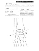 PARTIAL ANKLE JOINT REPLACEMENT IMPLANT diagram and image