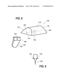 PARTIAL ANKLE JOINT REPLACEMENT IMPLANT diagram and image