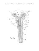 SLEEVE FOR MODULAR REVISION HIP STEM diagram and image