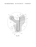 SLEEVE FOR MODULAR REVISION HIP STEM diagram and image