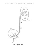 PARTIALLY SOLUBLE IMPLANTABLE OR INSERTABLE MEDICAL DEVICES diagram and image