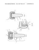 PROSTHETIC IMPLANT AND ASSEMBLY METHOD diagram and image